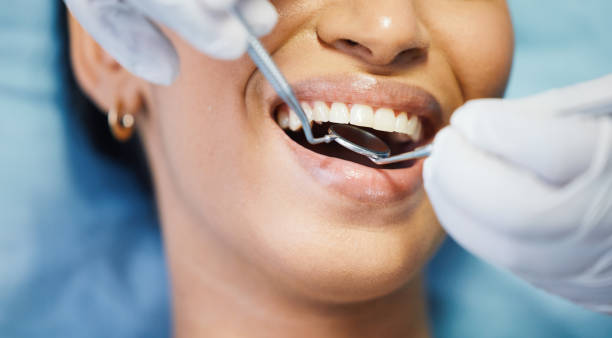 Best Emergency Cosmetic Dentistry in Hideo, UT