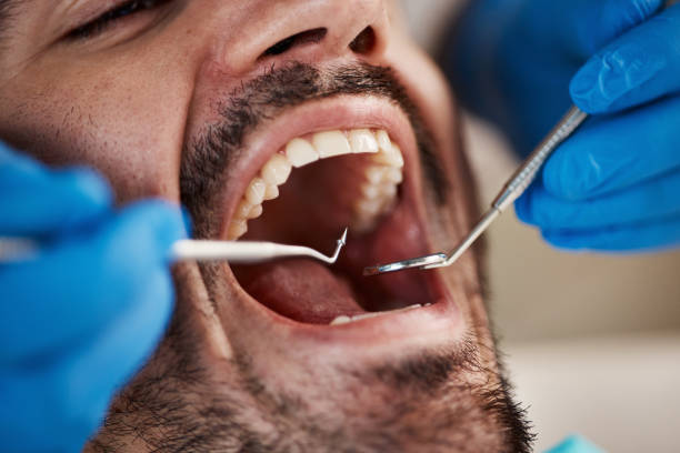 Best Emergency Dental Services for Seniors in Hideo, UT