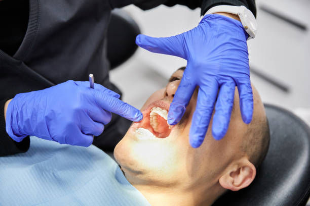 Best Emergency Dentist for Lost Fillings or Crowns in Hideo, UT